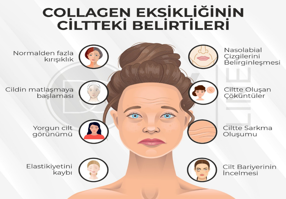 Kolajen Collagen Eksikliği ve Ciltteki Belirtileri